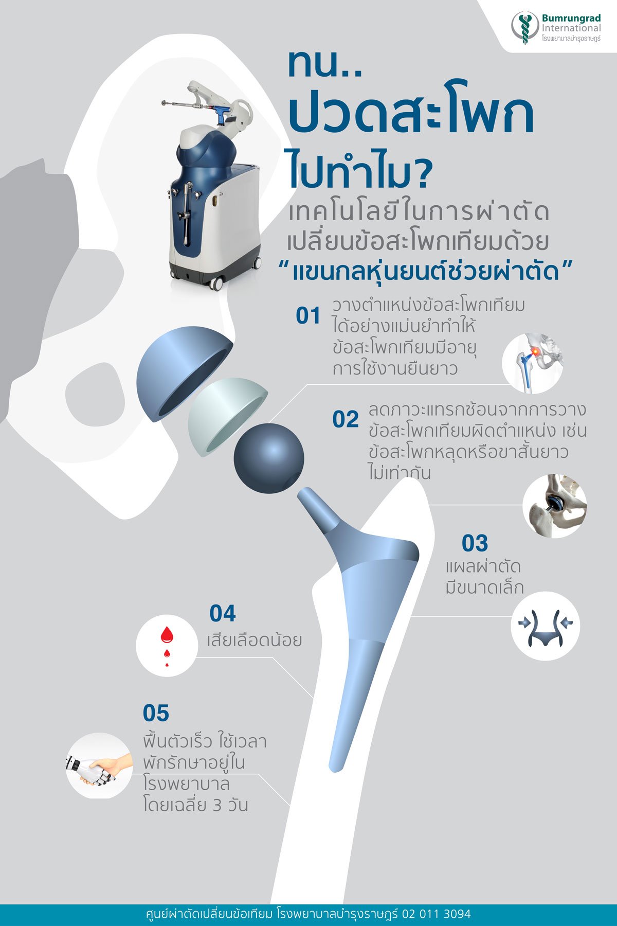 เทคโนโลยีในการผ่าตัดเปลี่ยนข้อสะโพกเทียมด้วยแขนหุ่นยนต์ช่วยผ่าตัด