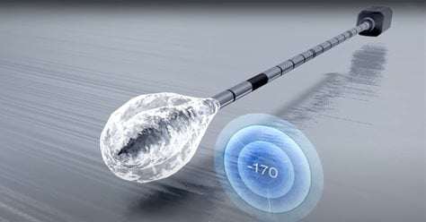 Cryoablation: The latest treatment for breast tumors