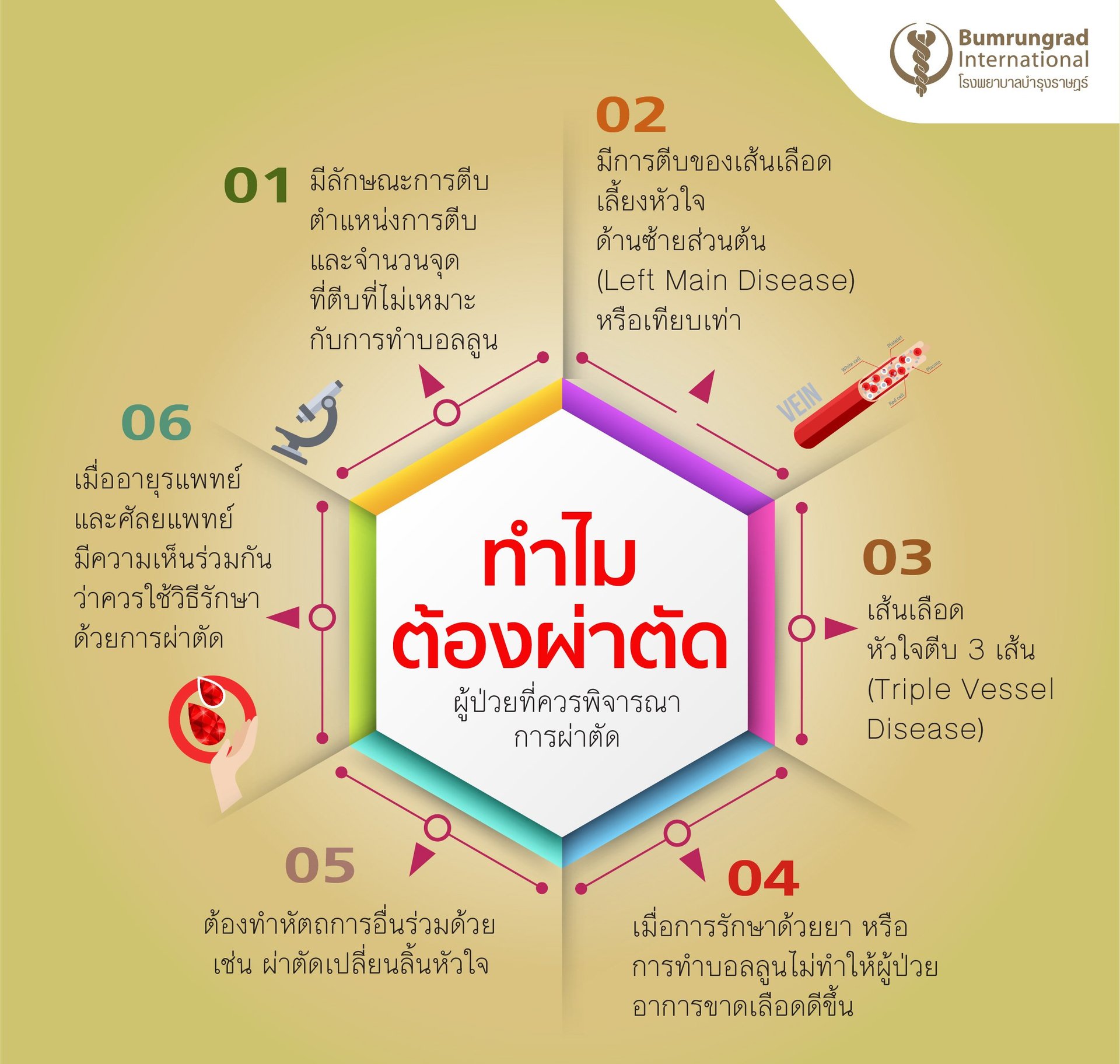 ทำไมต้องผ่าตัดบายพาสหัวใจ