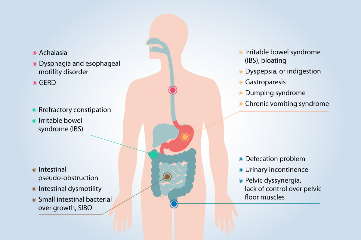 What's Motility Disorder?