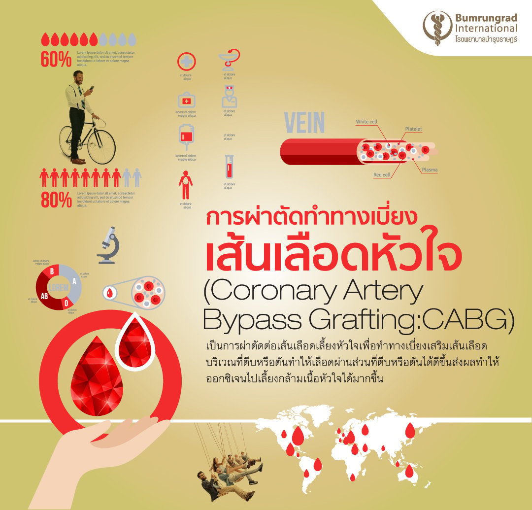 Infographic-Coronary-AW03-(1).jpg