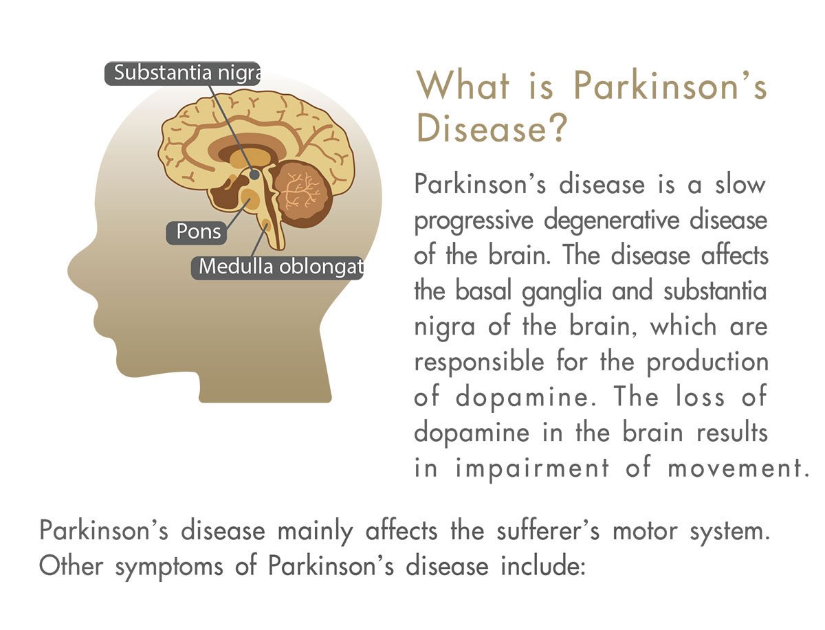 parkinson_1200X917.jpg