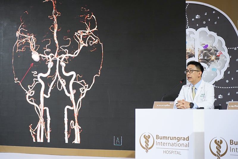 Bumrungrad International Hospital organizes a press conference of the