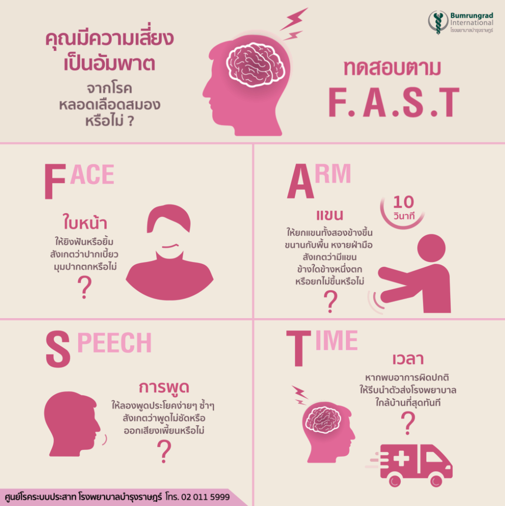 ทดสอบความเสี่ยงเป็นอัมพาต จากโรคหลอดเลือดสมอง