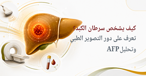 كيف يشخص سرطان الكبد؟ تعرف على دور التصوير الطبي وتحليل AFP