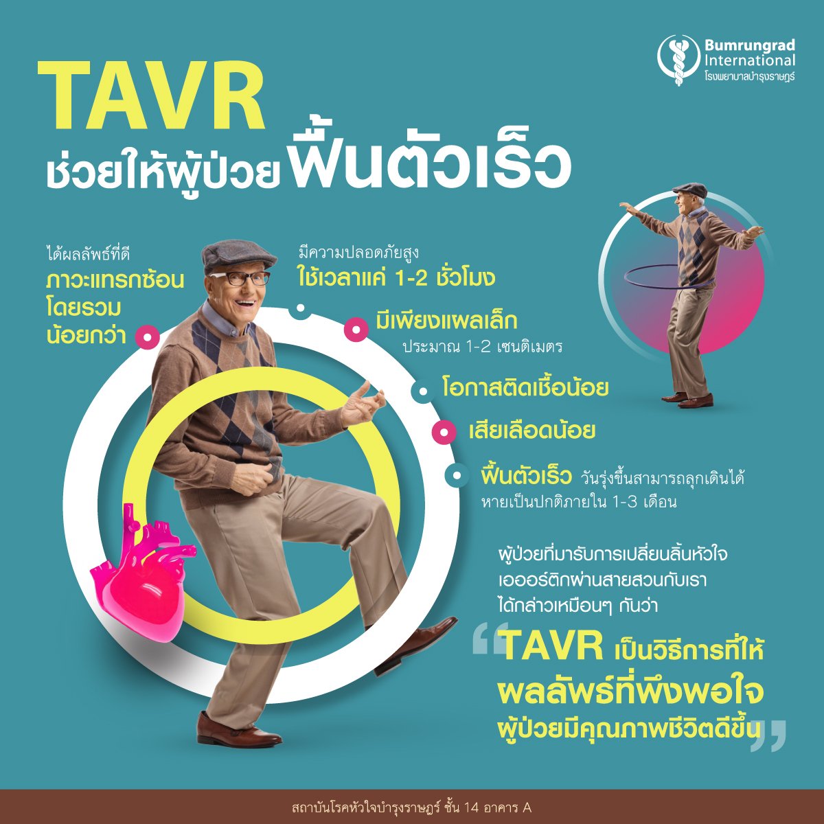 การเปลี่ยนลิ้นหัวใจเอออร์ติกผ่านสายสวน TAVIR