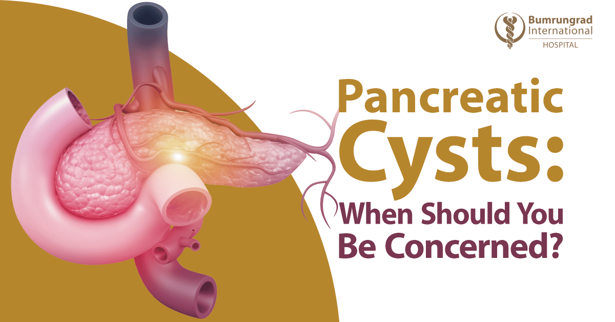Pancreatic Cysts: When Should You Be Concerned?