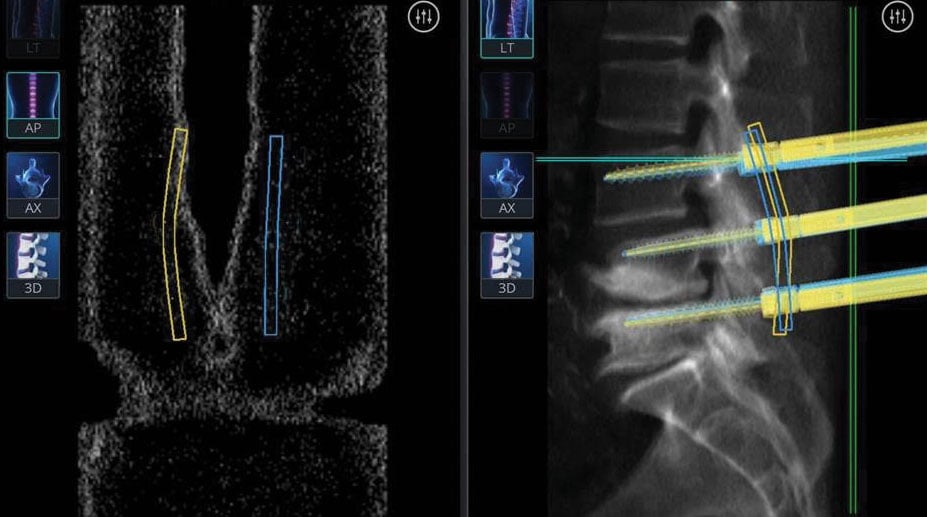 A Robot Cannot Replace the Surgeon bangkok