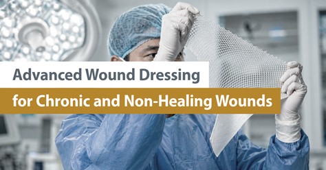 Advanced Wound Dressing for Chronic and Non-Healing Wounds