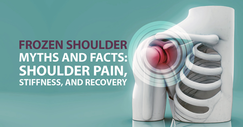 Frozen Shoulder Myths and Facts: Shoulder Pain, Stiffness, and Recovery