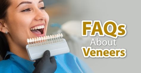 FAQs About Veneers