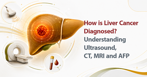 How Is Liver Cancer Diagnosed? Understanding Ultrasound, CT, MRI and AFP