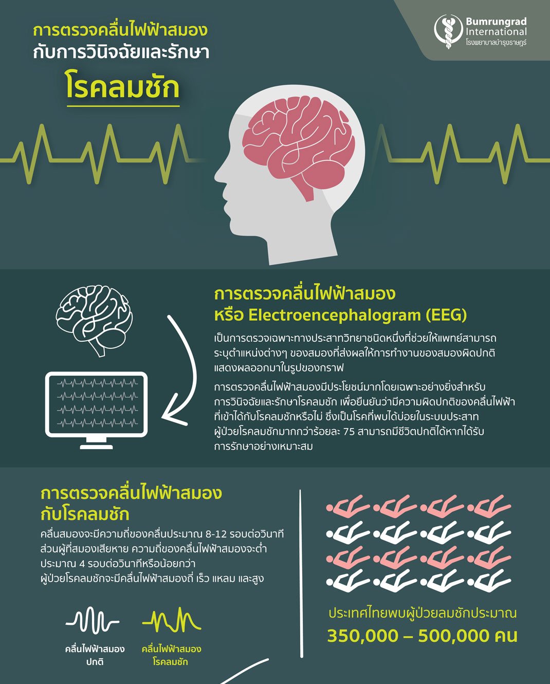 ตรวจคลนสมอง.jpg