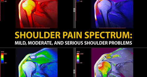 Shoulder Pain Spectrum: Mild, Moderate, and Serious Shoulder Problems