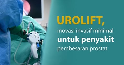 UROLIFT, inovasi invasif minimal untuk penyakit pembesaran prostat