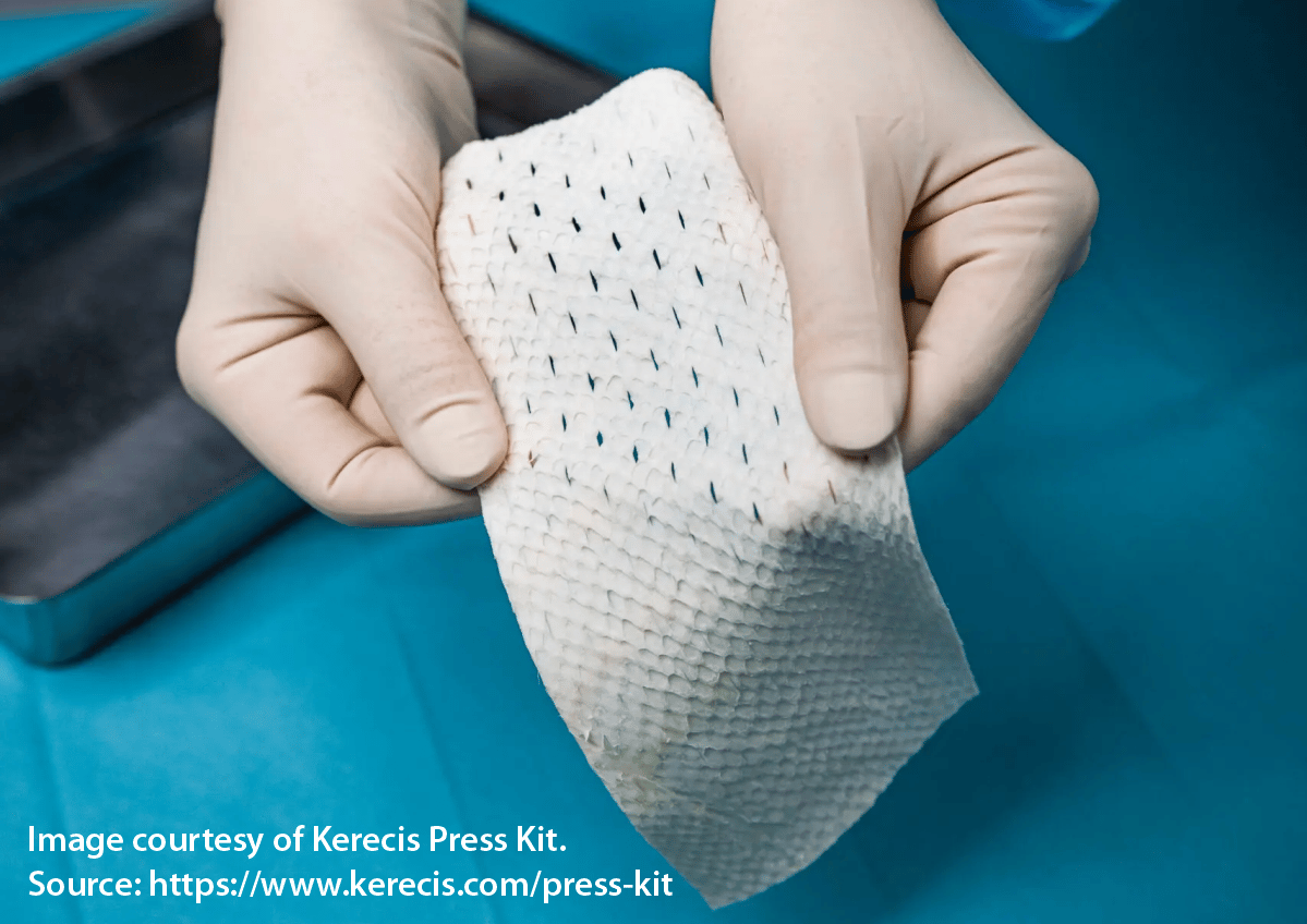 Advanced-Wound-Dressing-for-Chronic-and-Non-Healing-Wounds-Image-1.png