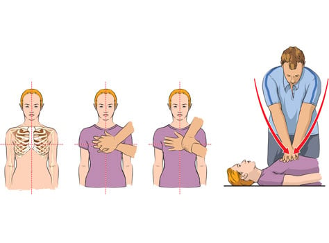 How to perform CPR thailand