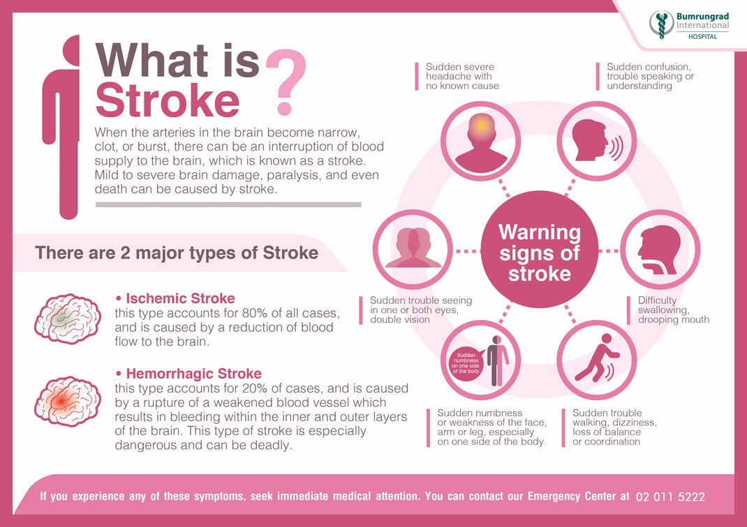 Are You Aware of the Dangers of Stroke? | Bumrungrad Hospital Thailand