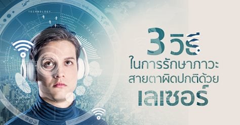 3 วิธีในการรักษาสายตาผิดปกติด้วยเลเซอร์