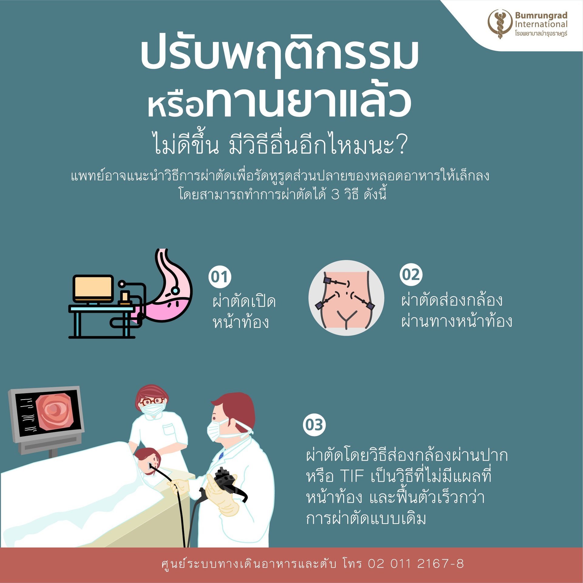 การรักษากรดไหลย้อน