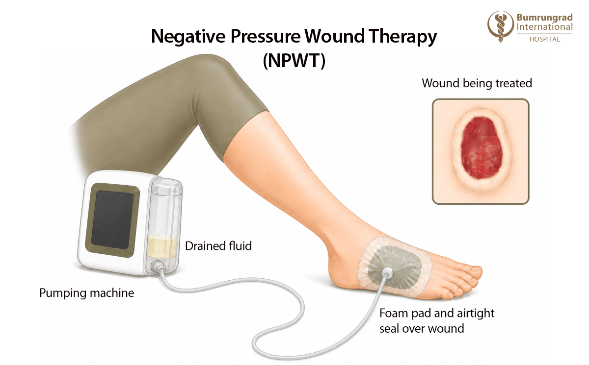 Advancing-Care-for-Chronic-and-Non-Healing-Wounds-image-2.png