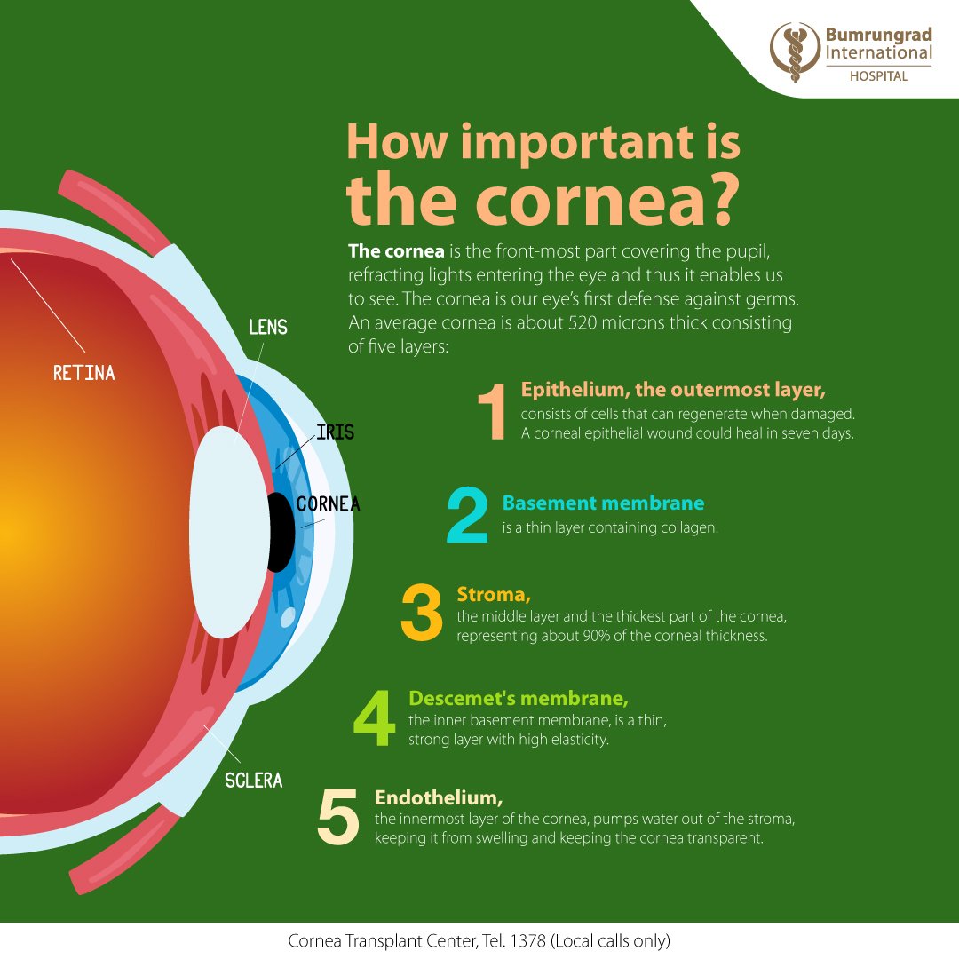 Layout-Cornea-Transplant-infographic_EN-01.jpg