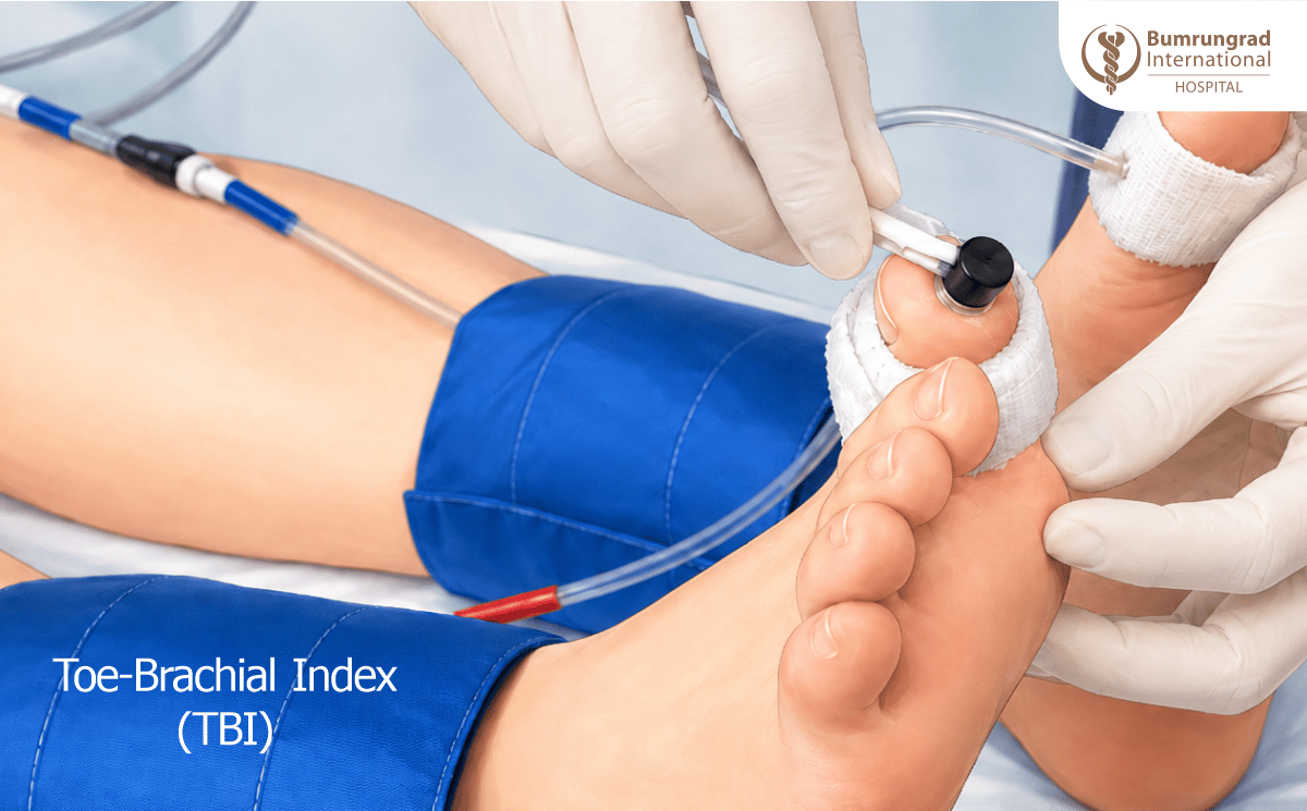 Wound-Care-Tests-Explained-ABI,-TBI,-and-TCOM-2-image-2.png