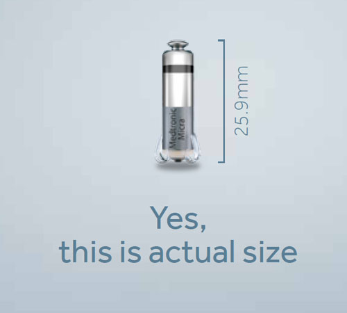 The_World_s_Smallest_Pacemaker-500x450-(2).jpg The_World_s_Smallest_Pacemaker-500x450-(2).jpg