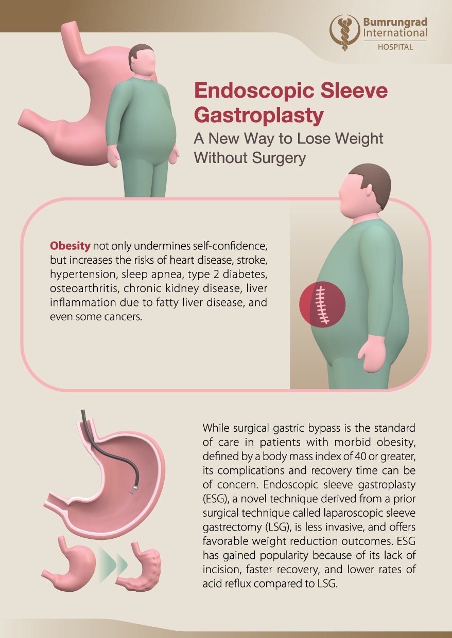 AW-ESG-brochure_A5-EN-01.jpg