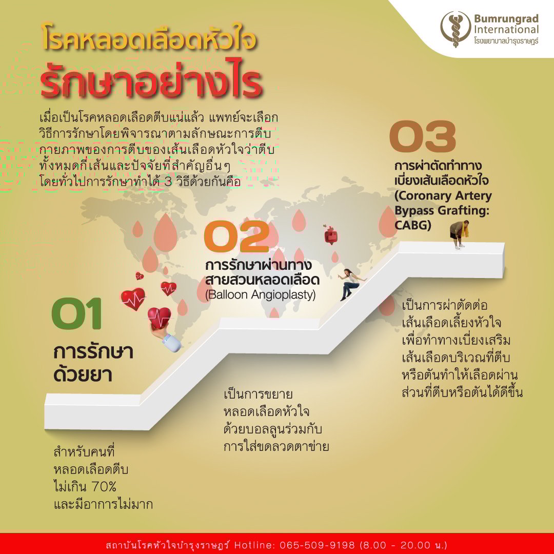แนวทางการรักษาโรคหลอดเลือดหัวใจ