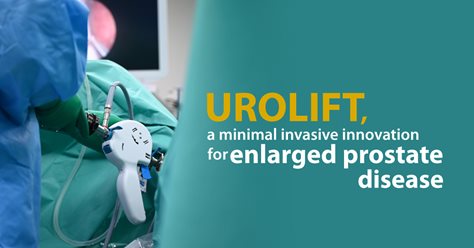 UROLIFT, a minimal invasive innovation for enlarged prostate disease