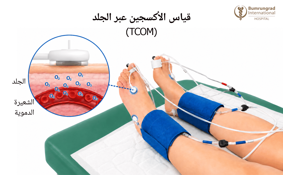 Wound-Care-Tests-Explained-ABI,-TBI,-and-TCOM-2-image-3-AR.png