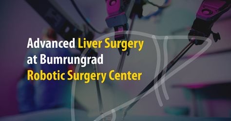 Advanced Liver Surgery at Bumrungrad Robotic Surgery Center