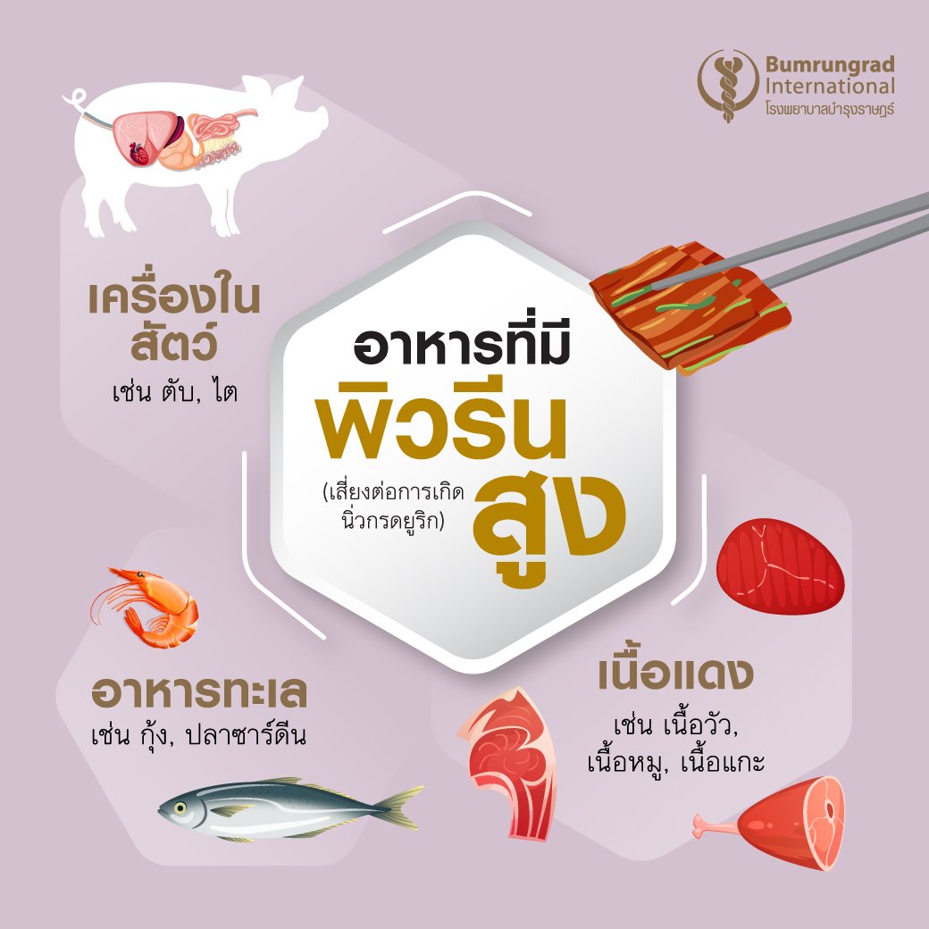 Layout-Daily-kidney-stone-prevention-tips-2_SM4.jpg