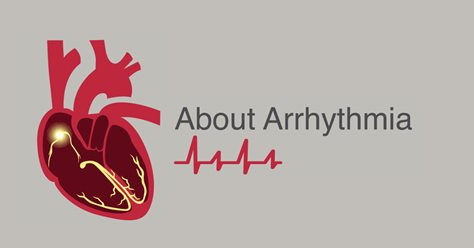 About Arrhythmia