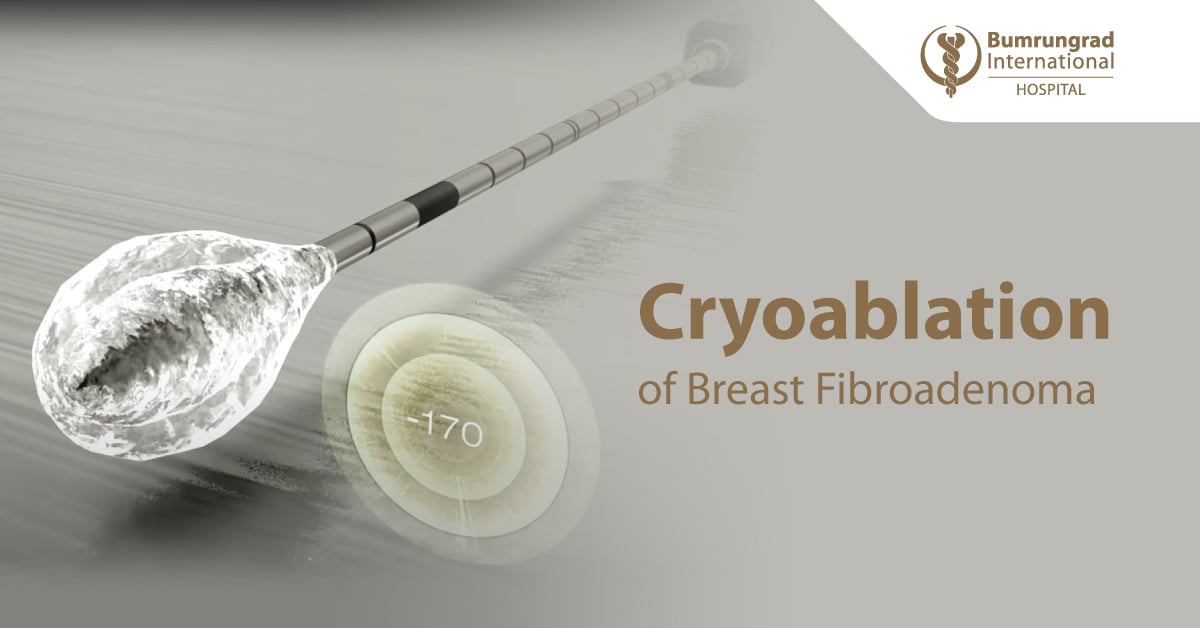 Layout-Horizon-Package_Cryoablation-of-Breast-Fibroadenoma-EN.jpg
