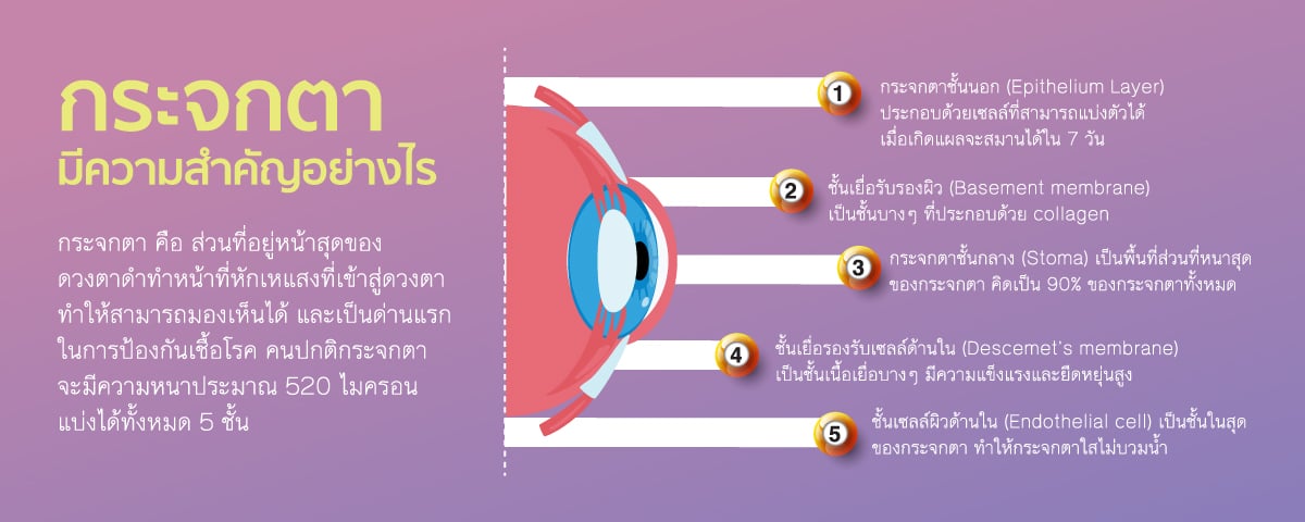 Cornea-Transplant_landing-page-TH-02.jpg