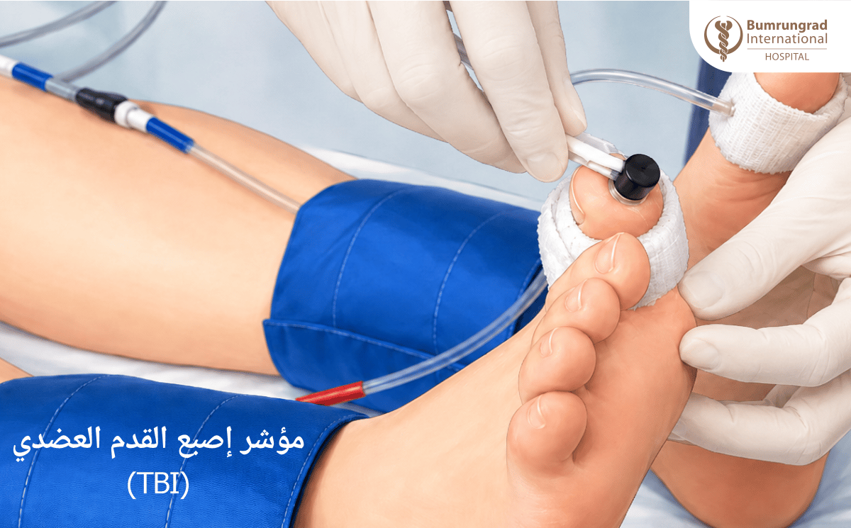 Wound-Care-Tests-Explained-ABI,-TBI,-and-TCOM-2-image-2-AR.png