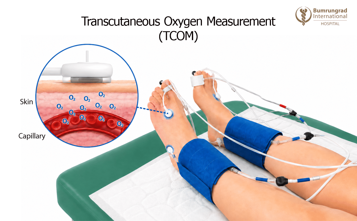 Wound-Care-Tests-Explained-ABI,-TBI,-and-TCOM-2-image-3.png