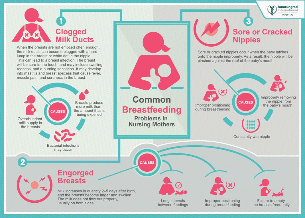 Common Breastfeeding Problems