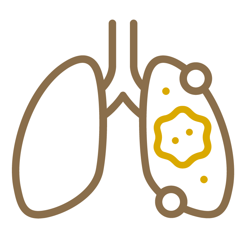 CT Photon Lung Cancer Screening