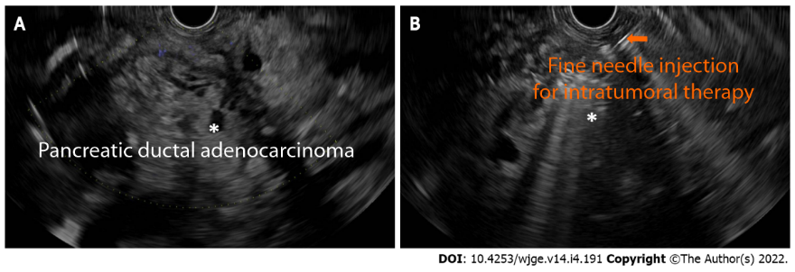 pancreatic-(2).png