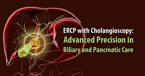 ERCP with Cholangioscopy: Advanced Precision in Biliary and Pancreatic Care