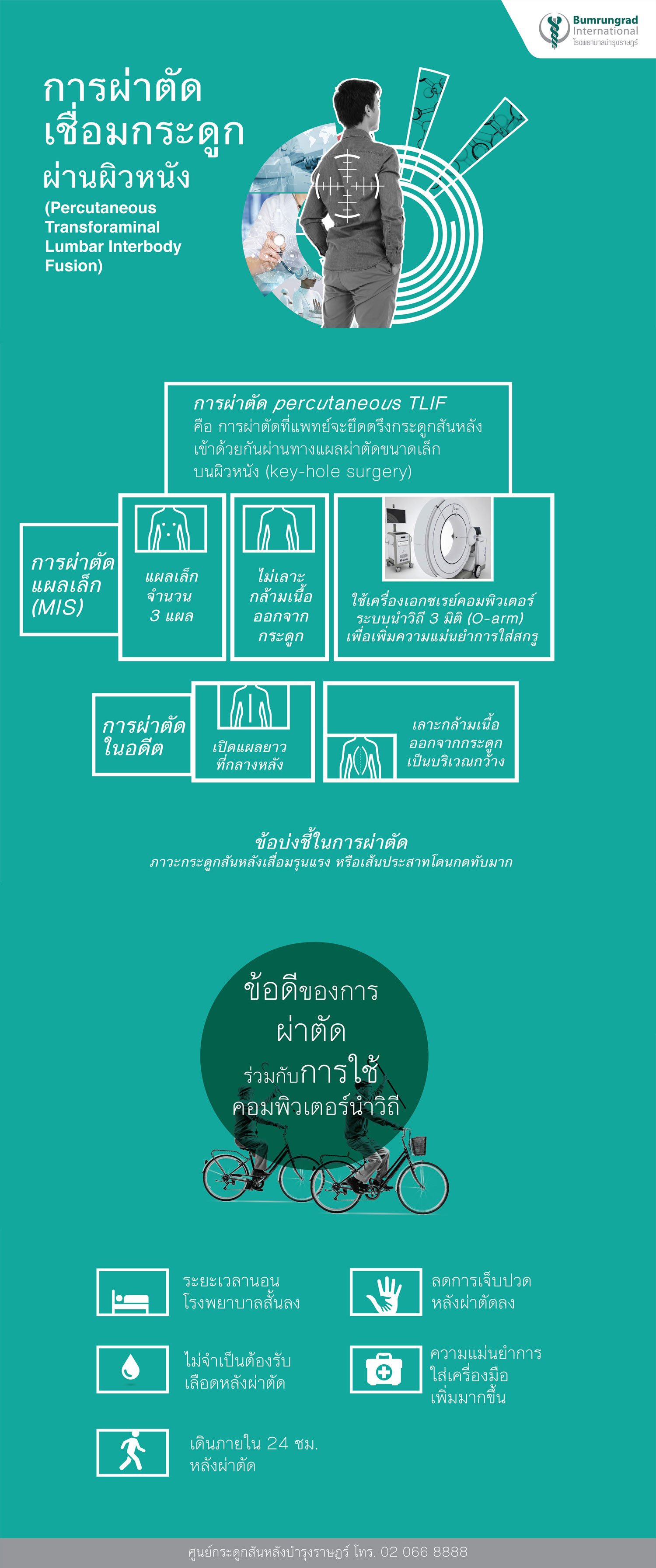 การผ่าตัด percutaneous TLIF ผ่าตัดเชื่อมกระดูกผ่านผิวหนัง infographic