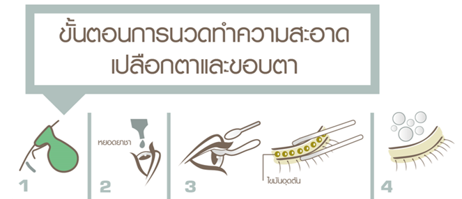 การนวดและทำความสะอาดเปลือกตาเพื่อรักษาอาการตาแห้ง | บำรุงราษฎร์ การนวดและทำความสะอาดเปลือกตาเพื่อรักษาอาการตาแห้ง | บำรุงราษฎร์