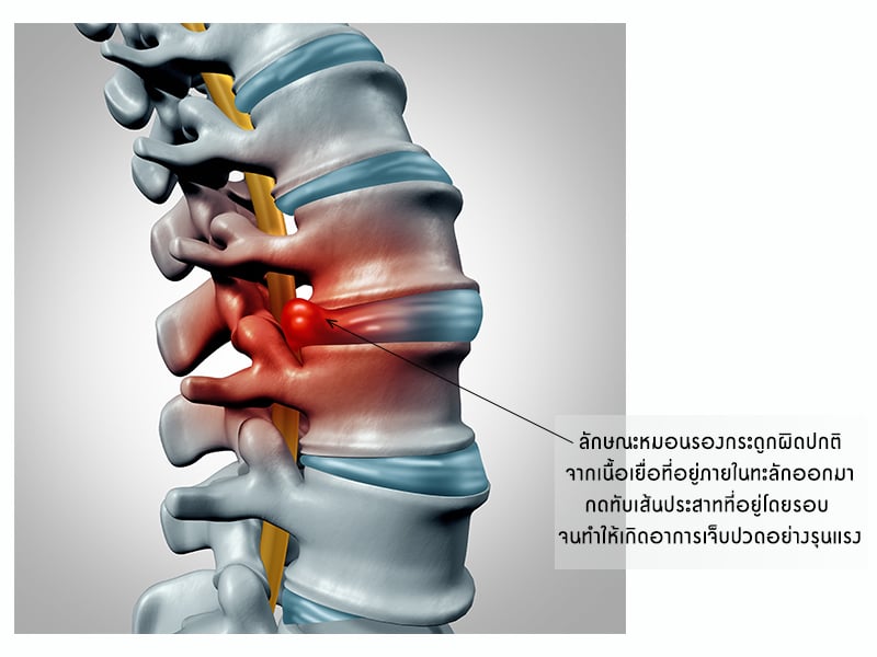 SPINE_TESI_Content_BIH1.jpg