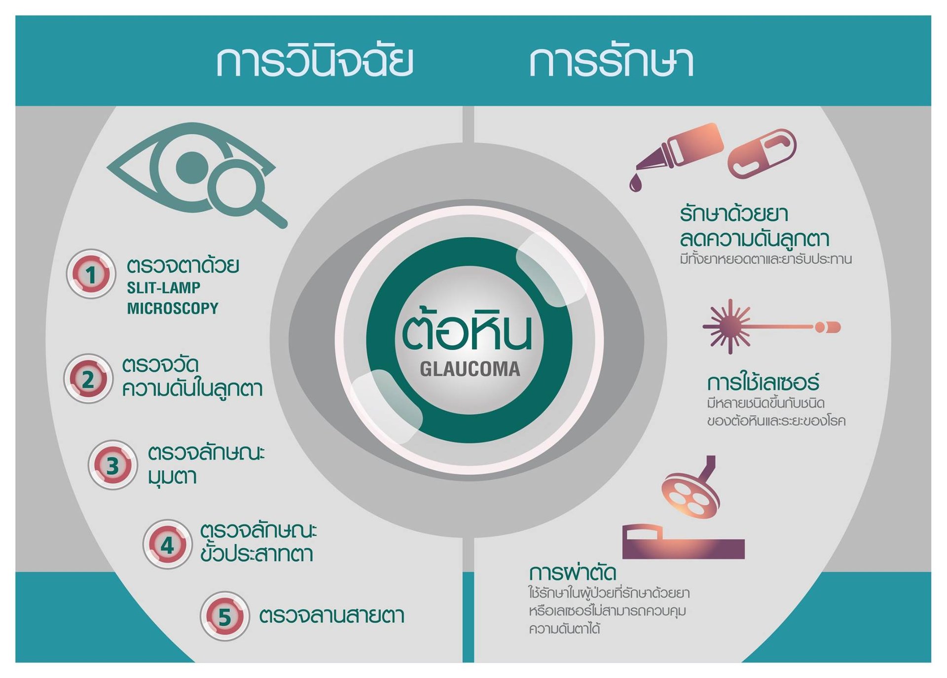 โรคต้อหินกับการรักษา Infographic การวินิจฉัย การรักษา