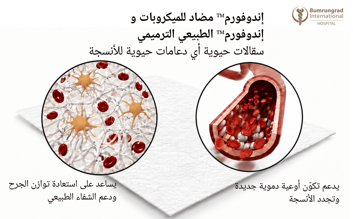 Advanced-Wound-Dressing-for-Chronic-and-Non-Healing-Wounds-Image-4-AR.png