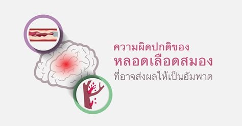 ความผิดปกติของหลอดเลือดสมอง