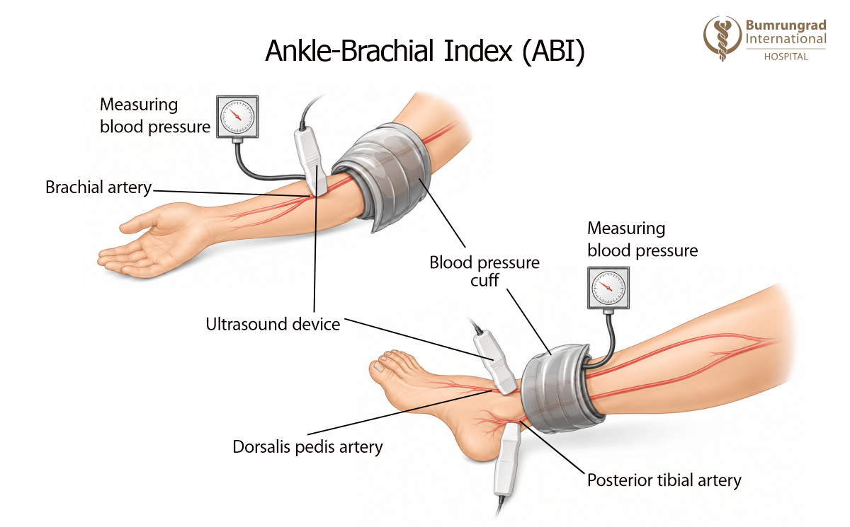 Wound-Care-Tests-Explained-ABI,-TBI,-and-TCOM-2-image-1.png